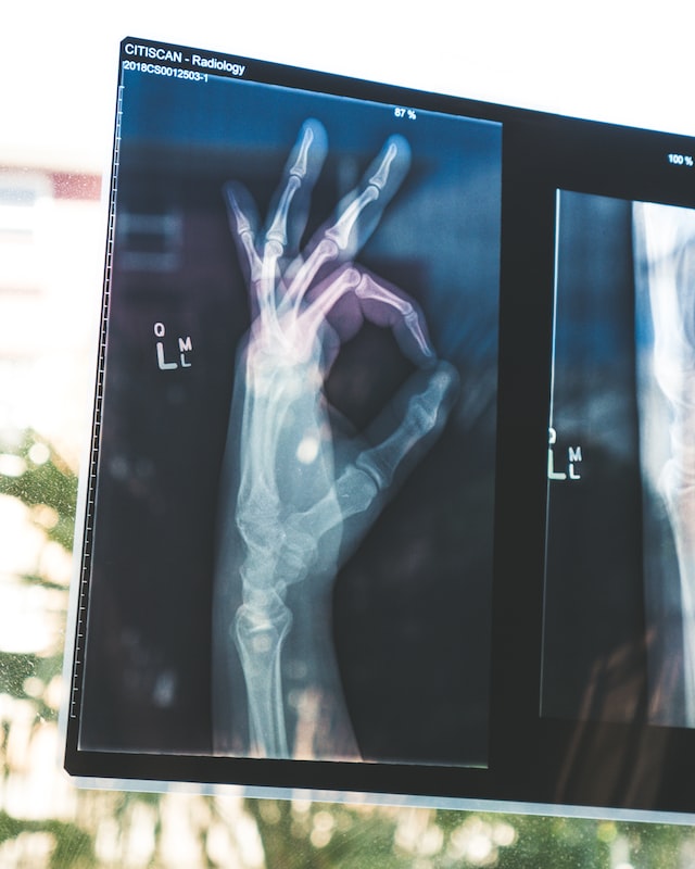 Feature Friday – Make Your Testing More Efficient With Xray Integration